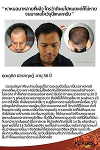 Hair Regrow Fall Thai Loss Tonic Herbs Hair 240ml Kowbu Shampoo Korea Stimulation (Pack of 2)